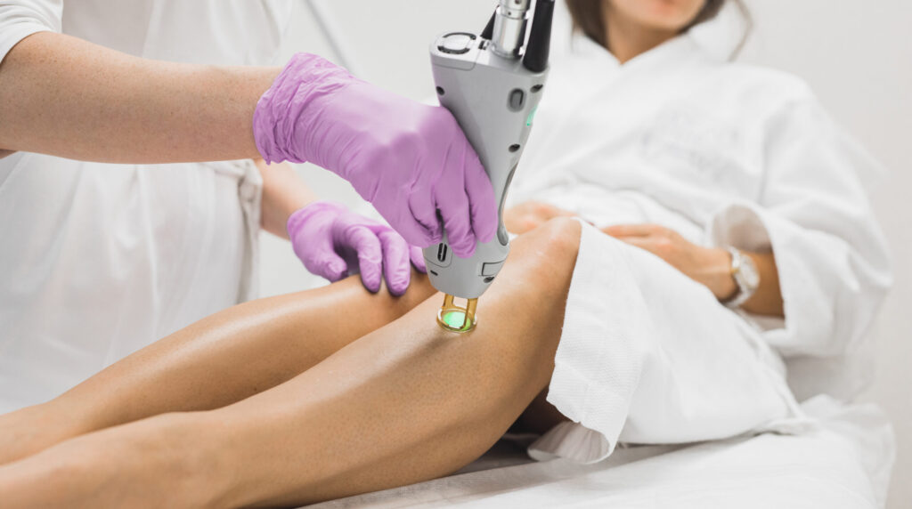 Laser hair removal on the legs