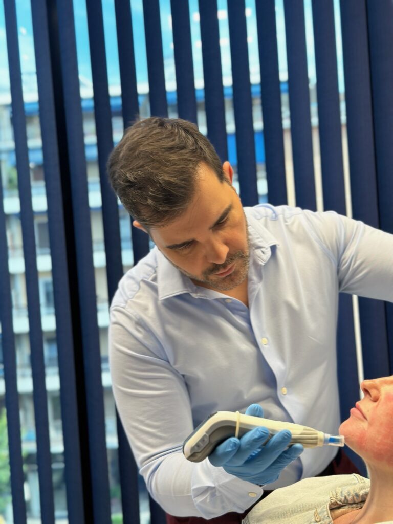 dermapen